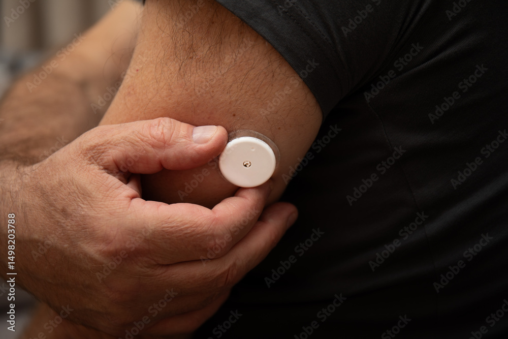 Glucose monitor on upper arm, side view Glucose monitor on upper arm, side view