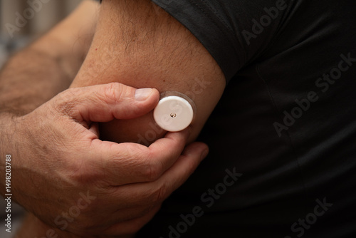 Glucose monitor on upper arm, side view