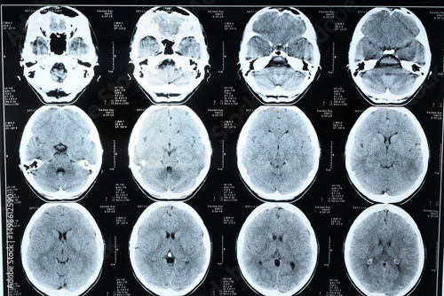 MRI scan of human head, clo...