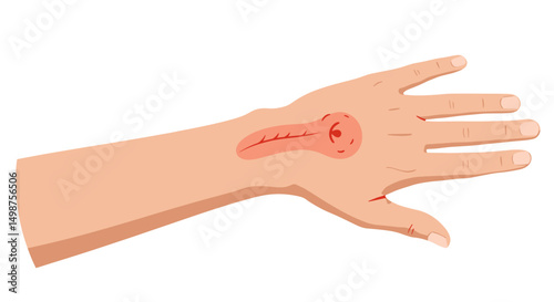 Illustration of a hand with a worm under the skin for health concept  