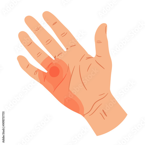 Human hand showing pain with red spots on palm illustration  