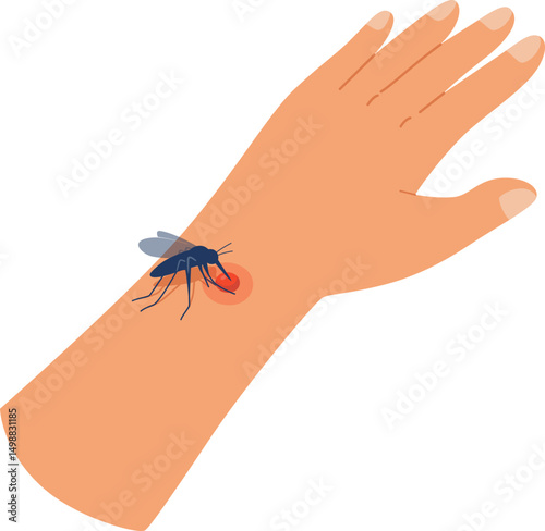 Mosquito Bites Human Hand Skin