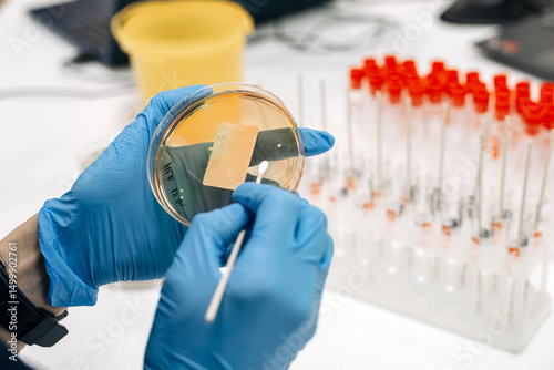 Bacterial colonies ferment lactose agar in the microbiology laboratory during an experiment. Concept studying and diagnosing intestinal infections using specialized culture media.
