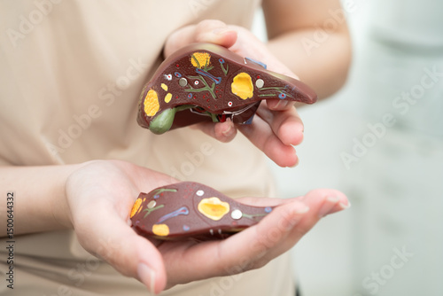 Cirrhosis, Liver cancer, fatty liver, Asian women with liver human anatomy model in World Hepatitis Day.