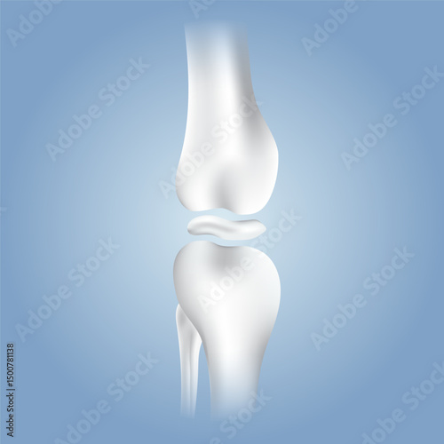 bone brokenbone health, medical graphic, x-ray knee, joint disease, health comparison