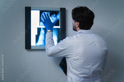 Doctor examining leg X-ray on lightbox, negatoscope medical professional analyzing radiograph image of lower limb injury, orthopedic diagnosis, hospital healthcare concept, radiology scene in clinic