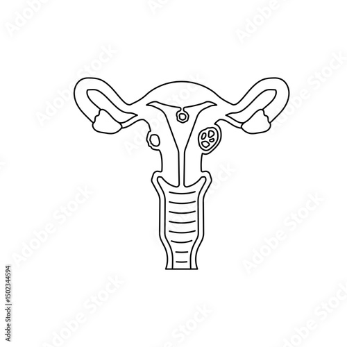 uterine fibroids