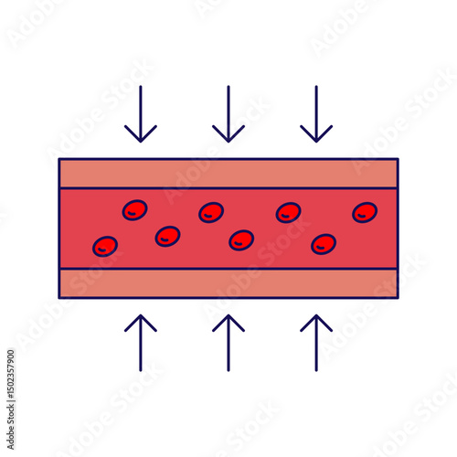 vasoconstriction