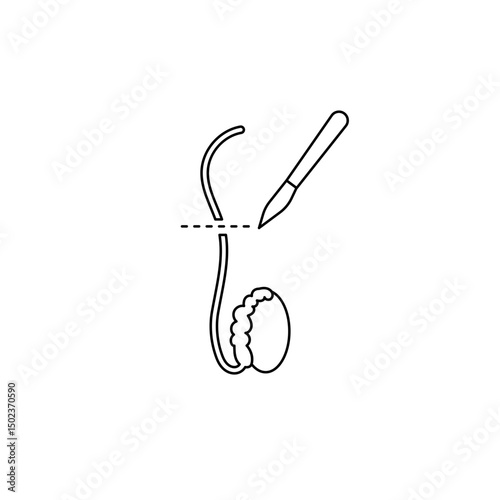 Vasectomy illustratrion