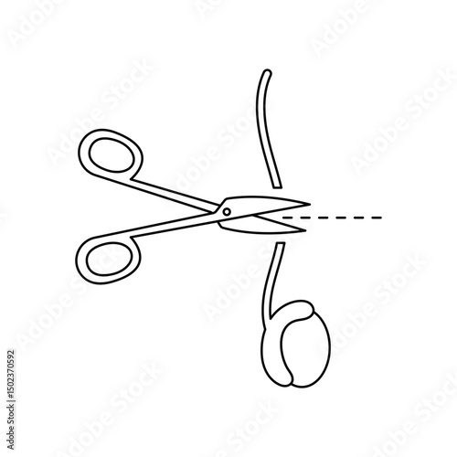 Vasectomy illustratrion