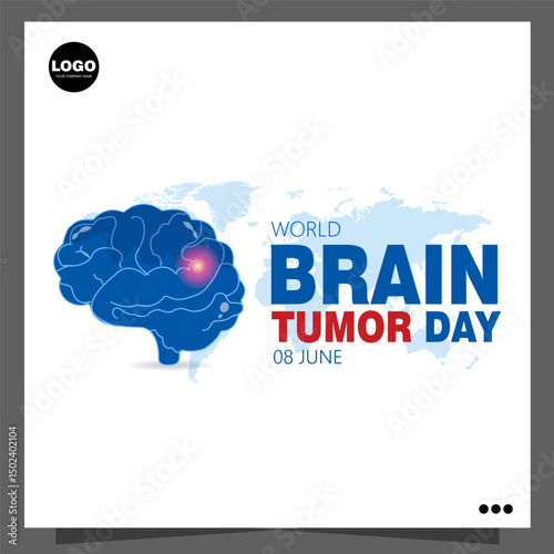 World Brain Tumor Day, observed annually on June 8th, raises awareness about brain tumors