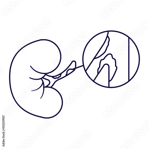 arthery disease