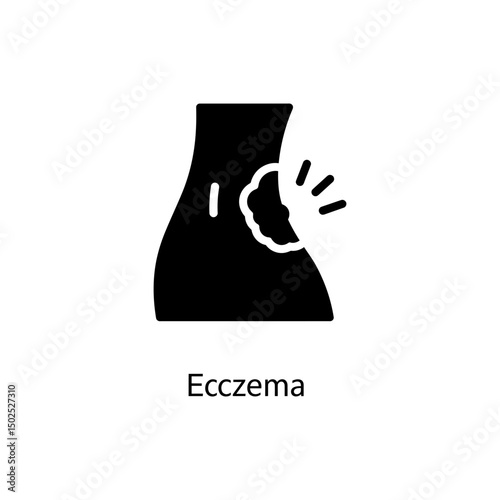 Eczema Itchy Skin Patch Dermatology Medical Skin Condition