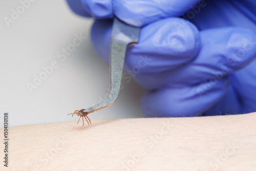Tick bitting on human skin
