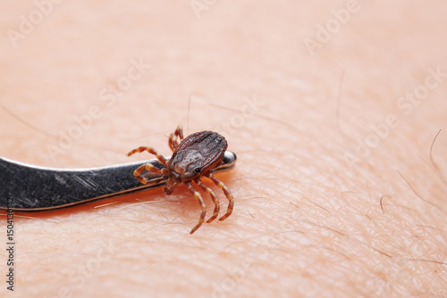 Tick bitting on human skin
