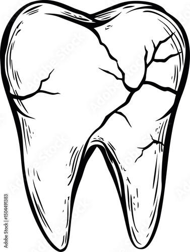 Illustration of cracked tooth with detailed black lines, dental health concept. Vector illustration