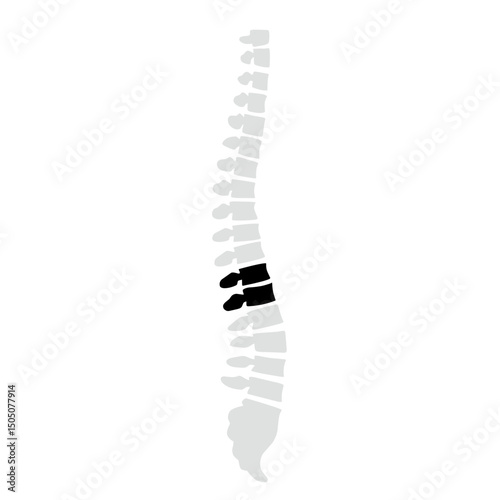 Spinal fracture vector illustration