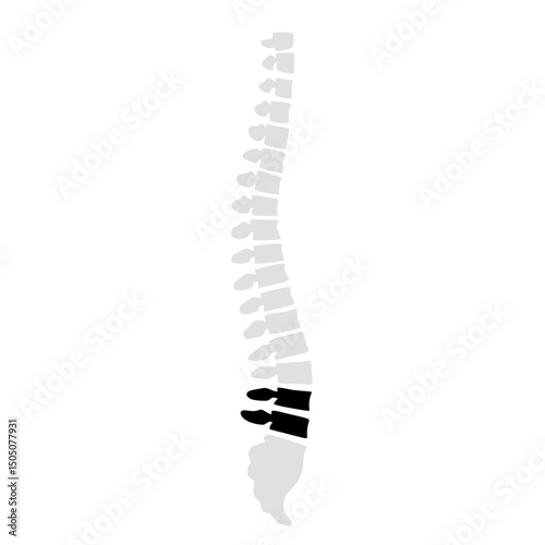 Spinal fracture vector illustration
