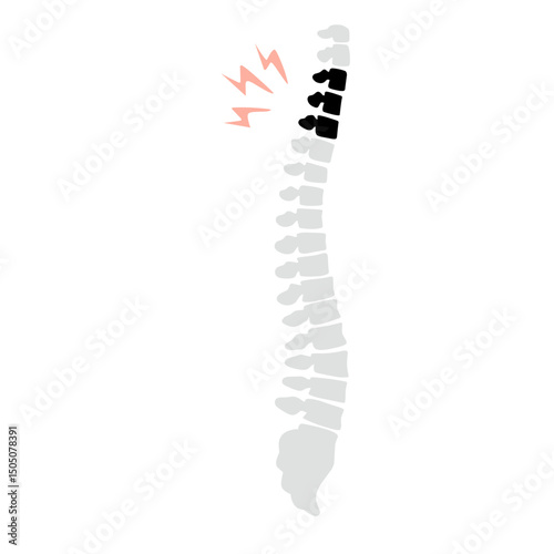 Spinal fracture vector illustration