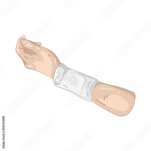 Illustration of Hand injury  