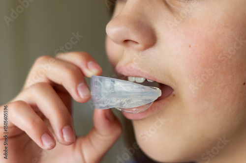 A child or teenager inserts a clear mouth guard into his mouth to straighten his teeth or bite. Side view, close-up. Orthodontic treatment