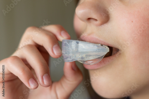 Orthodontic treatment of crooked teeth or malocclusion in a child with a silicone mouth guard or aligners. A teenager holds a mouth guard to his mouth. Close-up.