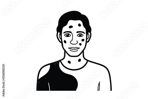 Young man with acne spots on face and neck