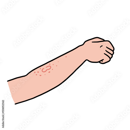 Itchy rash on forearm with red spots and copy space