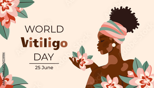 World vitiligo day. African American with vitiligo. Beautiful black woman with flowers. Skin diversity concept. Body positive and self love. Portrait art. Vector flat Illustration