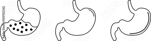 Human stomach vectors outline icons set. Digestive system anatomy. Human internal organ symbols. Health care, medical sign. Oncology procedure silhouette collection isolated on transparent background.