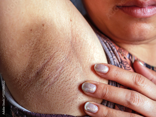 Photography Close-up of Women armpit with problem black armpit