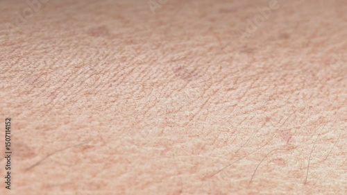 Young skin turning old surface macro gel rejuvenation, looped switch