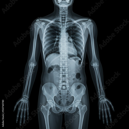 Detailed Full Body X-Ray Scan Showing Human Anatomy Structure
