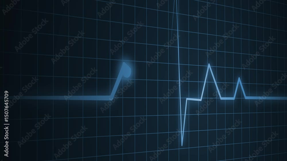 ECG Heartbeat Line on Grid Background, Electrocardiogram ECG Line ...