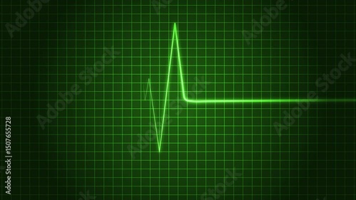 Heartbeat Signal Line Animation for Healthcare and Cardiology Themes