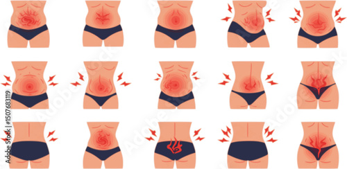 vector set of Bloating icons set. People experiencing digestive problems, discomfort, and symptoms related to stomach and gut health

