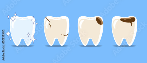 Healthy teeth, Cracked tooth, dental caries or tooth decayed . Set of flat design cartoon illustration . Isolated on Blue background . Vector .