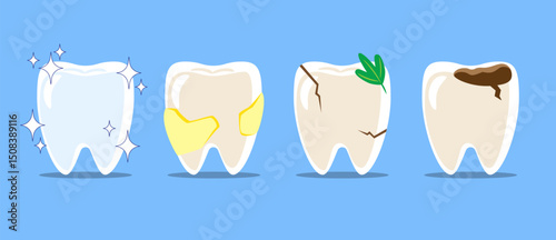 Healthy teeth, dental plaque, cracked tooth with food stuck, dental caries or tooth decayed . Set of flat design cartoon illustration . Isolated on Blue background . Vector .