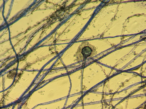 Bild auf Leinwand Fungal sporangium and hyphae under light microscop