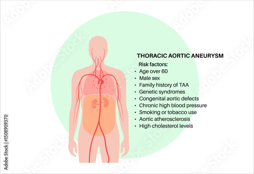 Thoracic aortic aneurysm