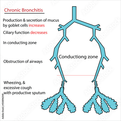 Chronic bronchitis Pathophysiology