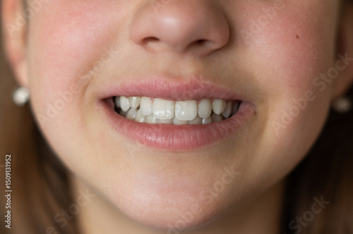 Even white healthy teeth of a child or person close-up front view. Correct bite of teeth