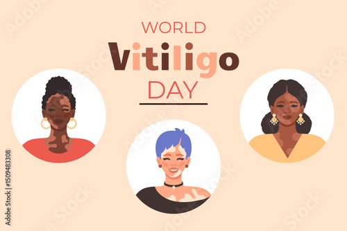 World vitiligo day banner. Diverse women with vitiligo patches. Happy People with vitiligo smiling. Promoting acceptance, equality and skin positivity. Vector flat cartoon Illustration