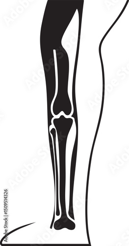 black silhouette depicts a leg and knee joint against a white background.