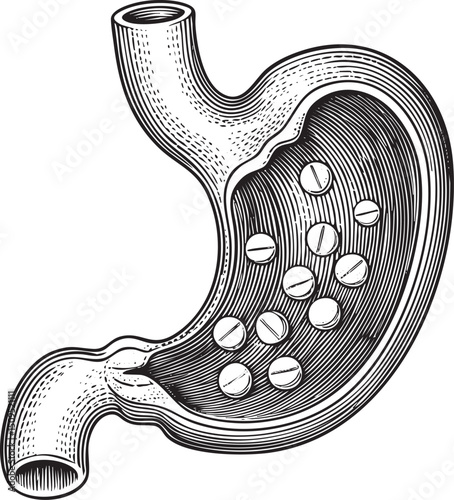 stylized stomach displays numerous pills arranged within its interior.