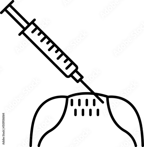Syringe injecting medicine into scalp during hair loss treatment in a clinical setting, representing modern medical solutions.