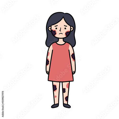 Young girl standing with visible skin condition in red dress  