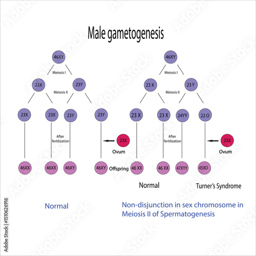 Non-disjunction in Sex chromosome in Meiosis II  of Spermatogenesis