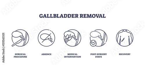 Gallbladder removal is shown with outline icons of surgery, absence, intervention, post-surgery, and recovery, transparent background. Outline icons set