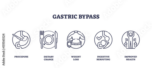 Gastric bypass is illustrated with outline icons showing surgery, dietary change, weight loss, digestive rerouting, and improved health, transparent background. Outline icons set